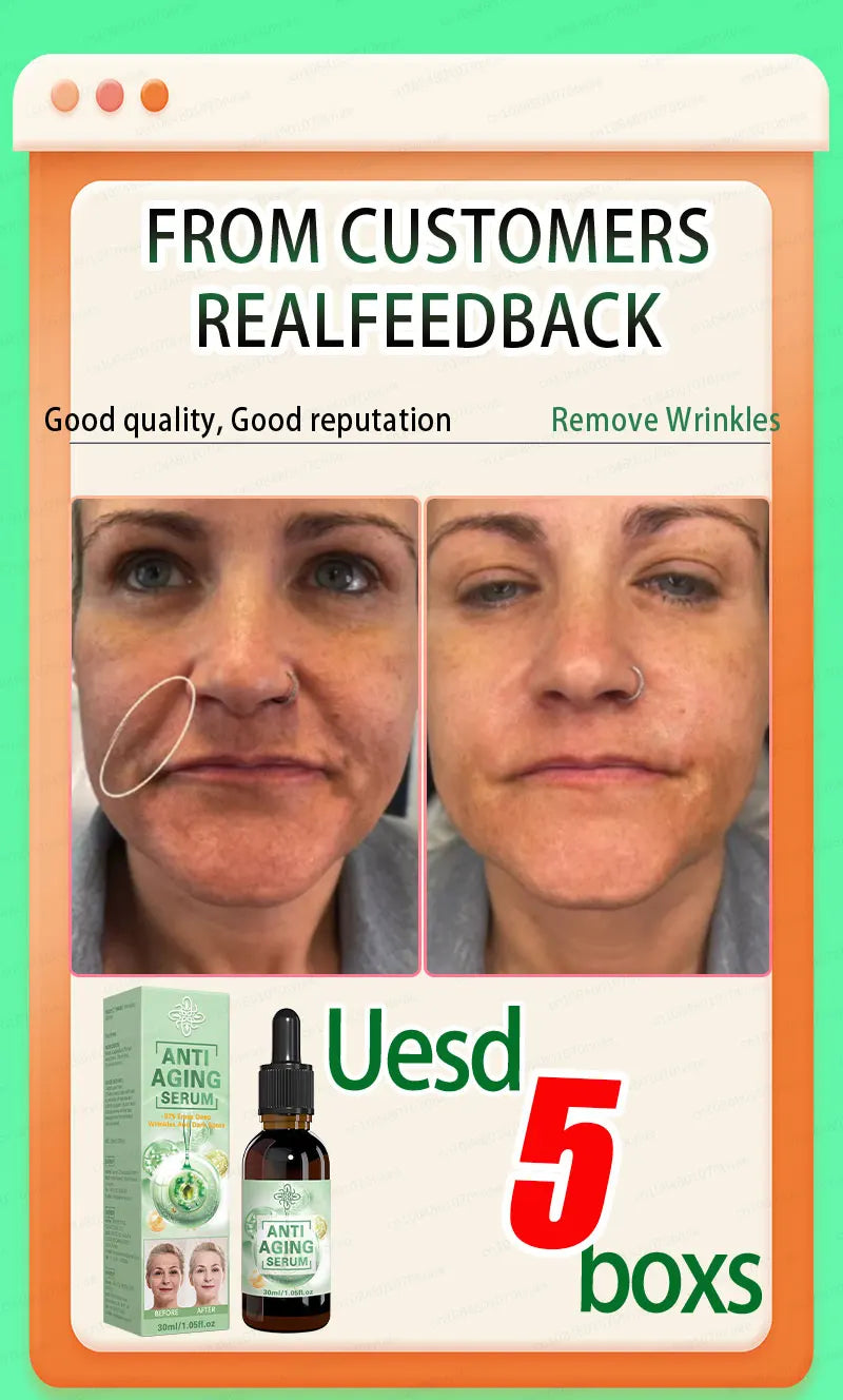 Wrinkles disappear, the first choice for beauty lovers