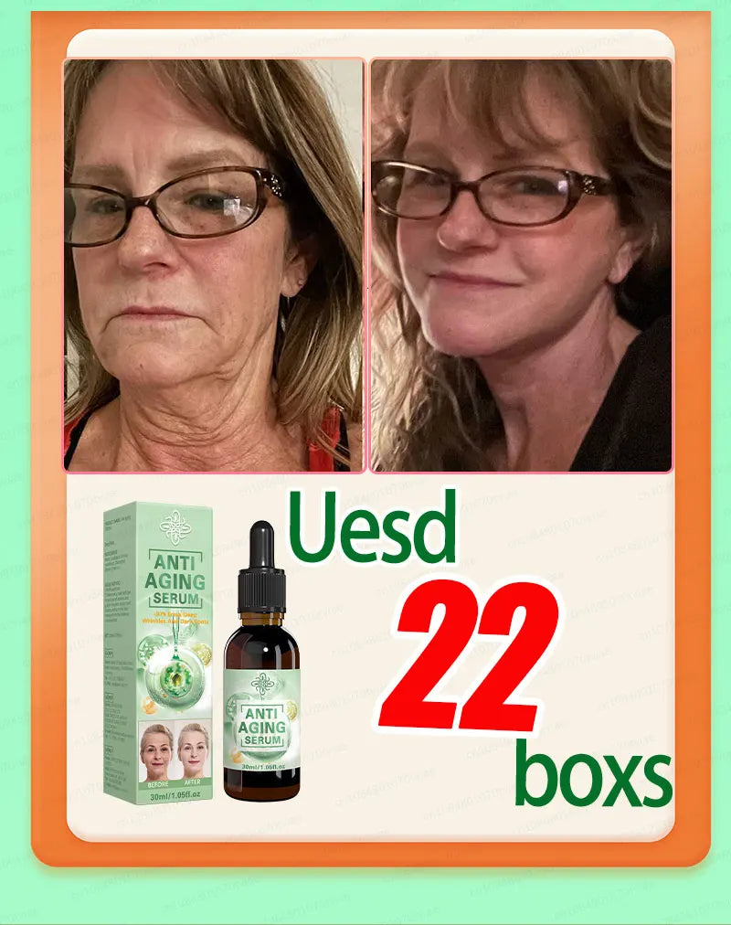 Wrinkles disappear, the first choice for beauty lovers