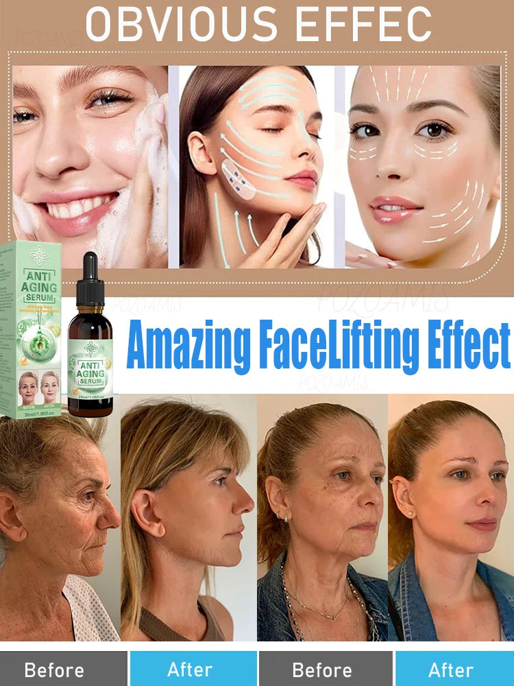 Wrinkles disappear, the first choice for beauty lovers